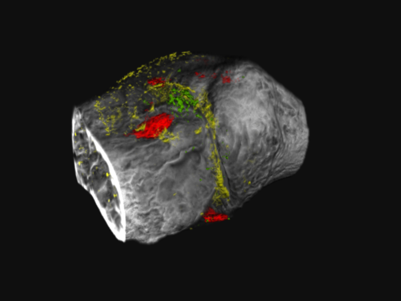 <p>Medical imaging is no longer in Kansas, Toto, as a team led by Penn State researchers brings traditional black and white diagnostic images of X-rays and traditional CT scans into technicolor. The researchers developed novel contrast agents that target two proteins implicated in osteoarthritis, a degenerative joint disease commonly characterized as wear-and-tear arthritis.</p>