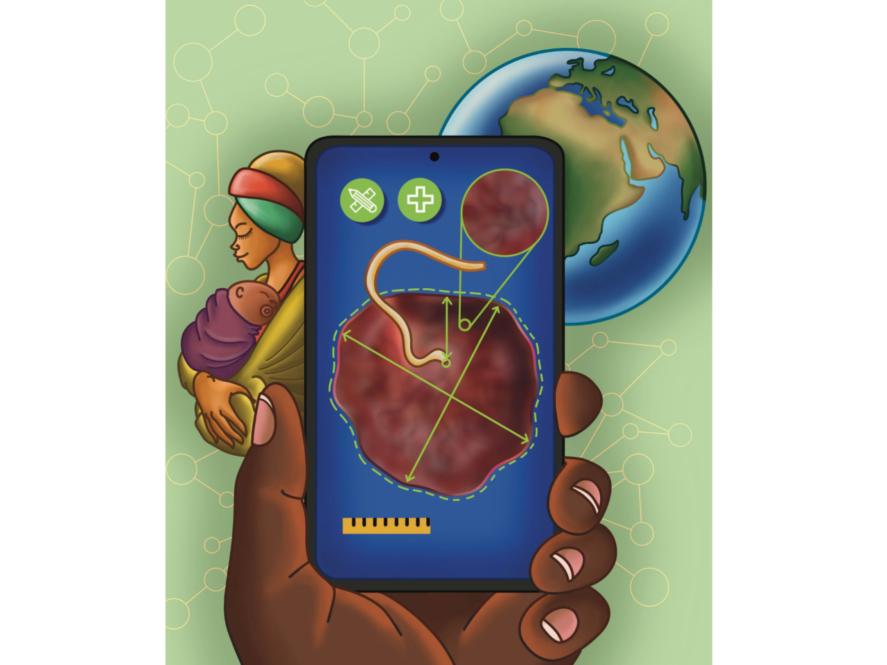 <p>A multi-national, multi-institutional team led by Penn State researchers developed a new tool that enables doctors to examine placentas right at the bedside using just a phone. The tool could make placental examination more accessible, saving lives and improving health outcomes, the team said. </p>
<p> </p>
