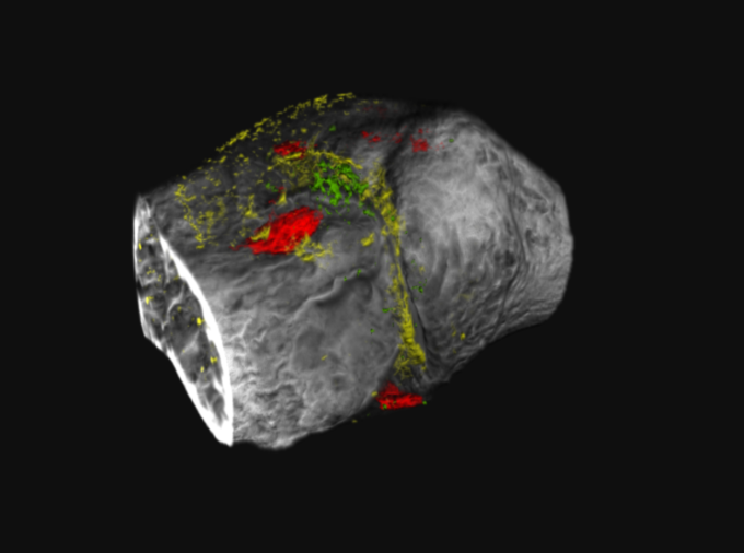 <p>Medical imaging is no longer in Kansas, Toto, as a team led by Penn State researchers brings traditional black and white diagnostic images of X-rays and traditional CT scans into technicolor. The researchers developed novel contrast agents that target two proteins implicated in osteoarthritis, a degenerative joint disease commonly characterized as wear-and-tear arthritis.</p>