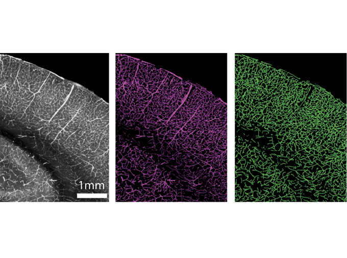 <p>A team of researchers from Penn State College of Medicine identified mouse brain regions vulnerable to blood vessel degeneration, offering clues to the connection between vasculature and neurodegenerative disease. They published their findings in Nature Communications.</p>