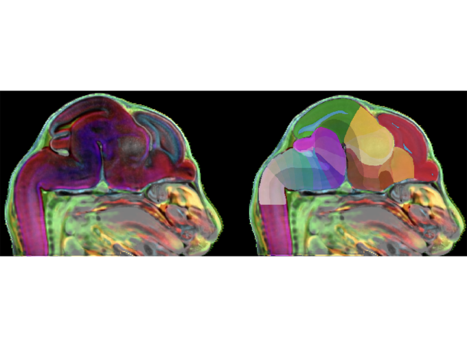 <p>A team of researchers at Penn State College of Medicine and collaborators from five different institutes has created a 3D atlas of developing mice brains, providing a more dynamic understanding of how the mammalian brain develops. This atlas provides a common reference and anatomical framework to help researchers understand brain development and study neurodevelopmental disorders.</p>